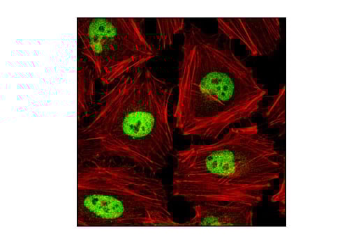 Immunofluorescence Image 1: AP-2α (C83E10) Rabbit mAb