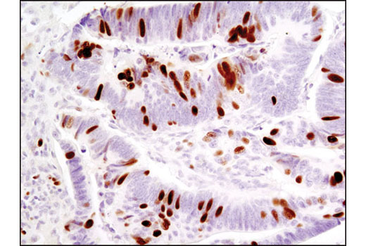 Immunohistochemistry Image 1: Phospho-Rb (Ser807/811) (D20B12) XP<sup>®</sup> Rabbit mAb (BSA and Azide Free)