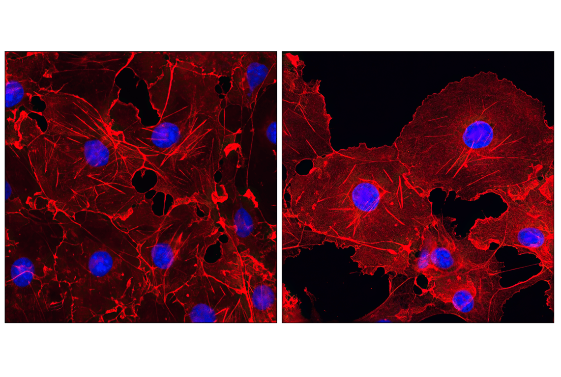 Immunofluorescence Image 1: β-Actin (13E5) Rabbit mAb (Alexa Fluor<sup>®</sup> 555 Conjugate)