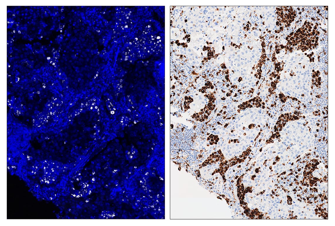 Immunohistochemistry Image 6: CD68 (D4B9C) & CO-0007-594 SignalStar<sup>™</sup> Oligo-Antibody Pair