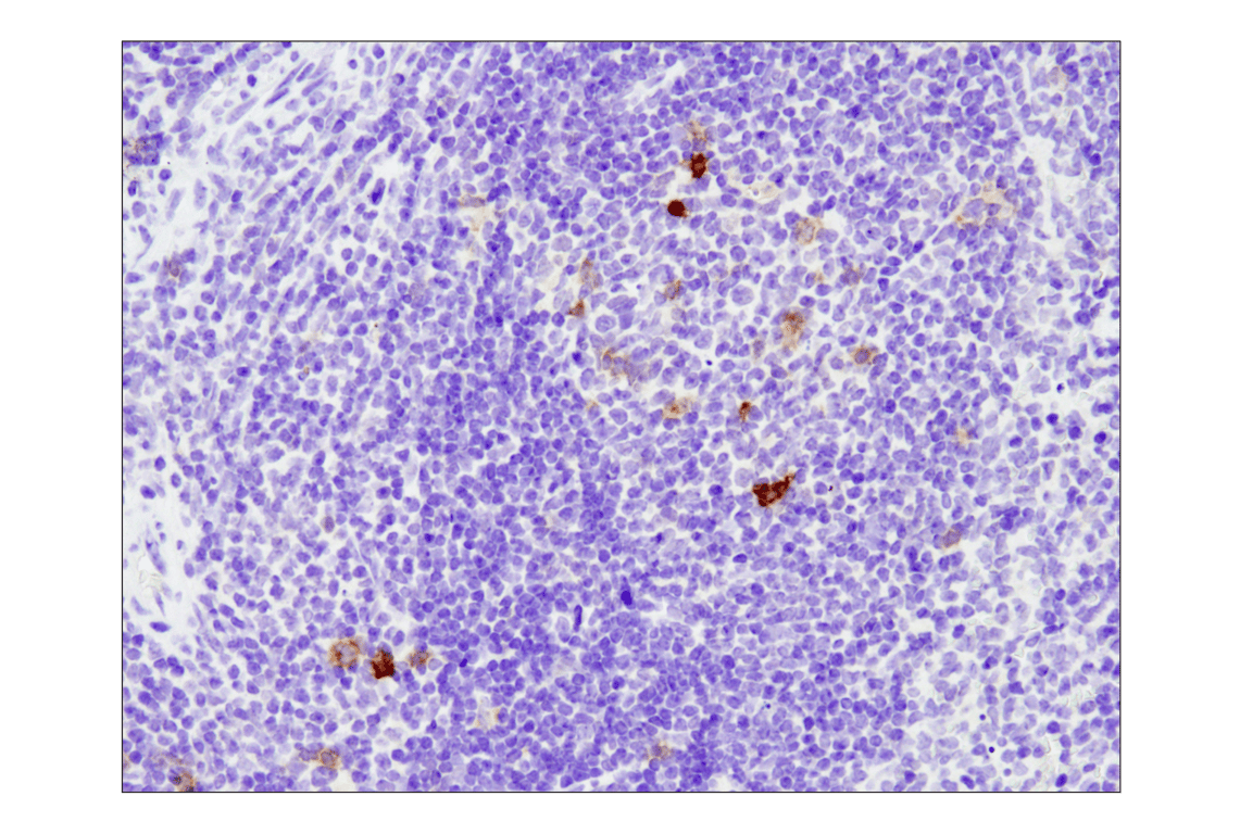 Immunohistochemistry Image 1: TNFRSF8/CD30 (E4L4I) XP<sup>®</sup> Rabbit mAb (BSA and Azide Free)