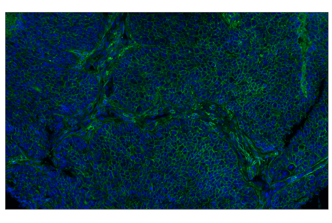 Immunohistochemistry Image 1: CD44 (E7K2Y) XP<sup>®</sup> Rabbit mAb (Alexa Fluor<sup>®</sup> 488 Conjugate)