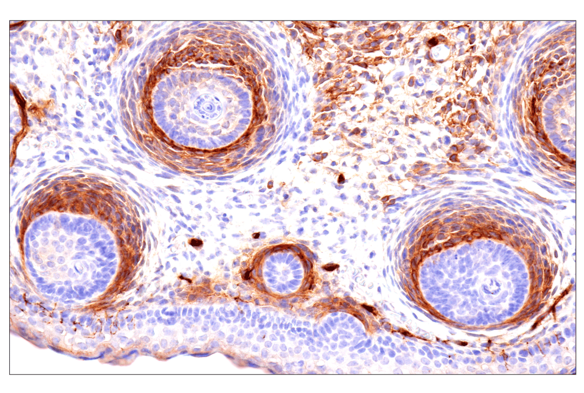 Immunohistochemistry Image 19: p75NTR (E7I3M) Rabbit mAb