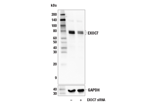 Western Blotting Image 1: EXOC7 (E4W6R) Rabbit mAb