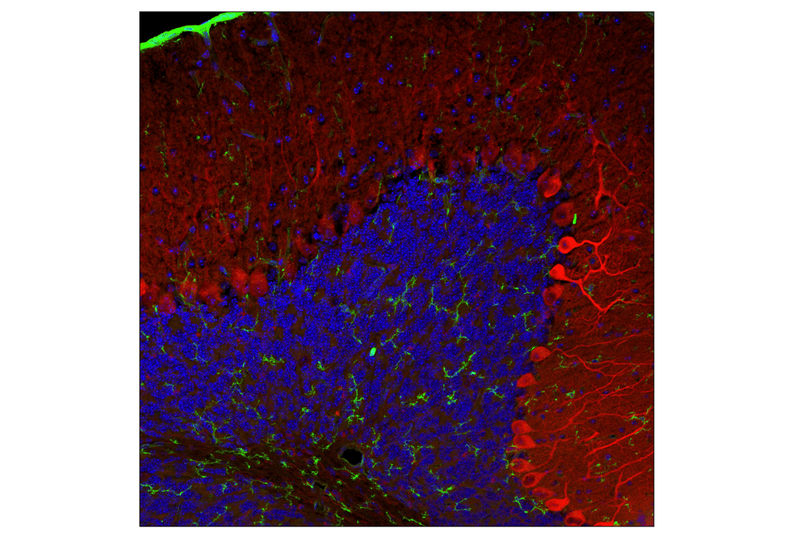 Immunofluorescence Image 1: PIP4K2C (E7P3S) Rabbit mAb (Alexa Fluor<sup>®</sup> 647 Conjugate)