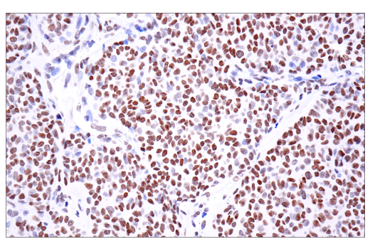 undefined Image 60: BAF Complex IHC Antibody Sampler Kit