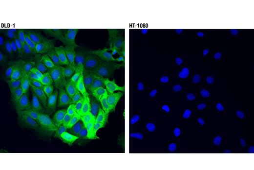 Immunofluorescence Image 1: ASS1 (D4O4B) XP<sup>®</sup> Rabbit mAb