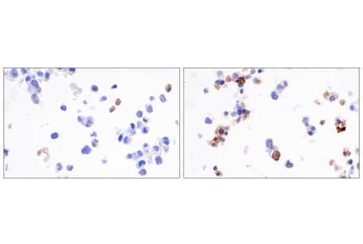 undefined Image 45: Human Reactive PANoptosis Antibody Sampler Kit