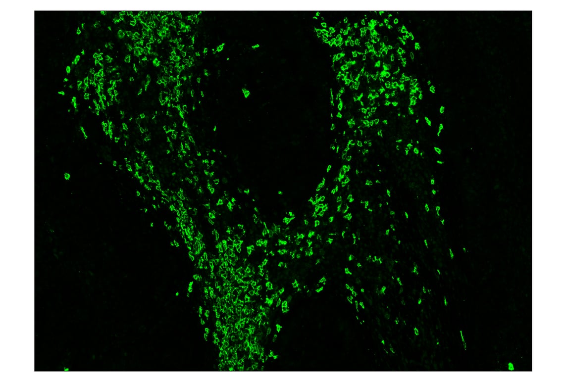 Immunohistochemistry Image 2: CD20 (E7B7T) & CO-0011-750 SignalStar<sup>™</sup> Oligo-Antibody Pair