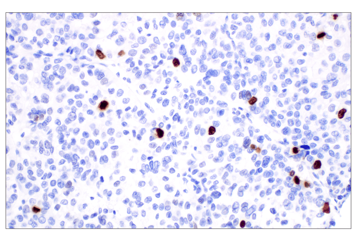 Immunohistochemistry Image 1: Phospho-Histone H3 (Ser10) (D7N8E) XP<sup>®</sup> Rabbit mAb (BSA and Azide Free)