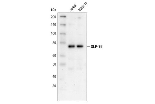 Western Blotting Image 1: SLP-76 Antibody