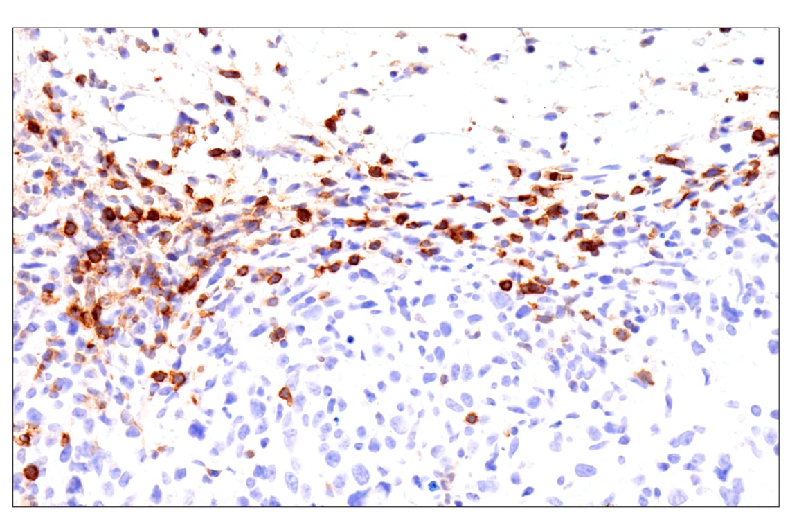 Immunohistochemistry Image 1: CD62L/L-Selectin (E7L2M) Rabbit mAb
