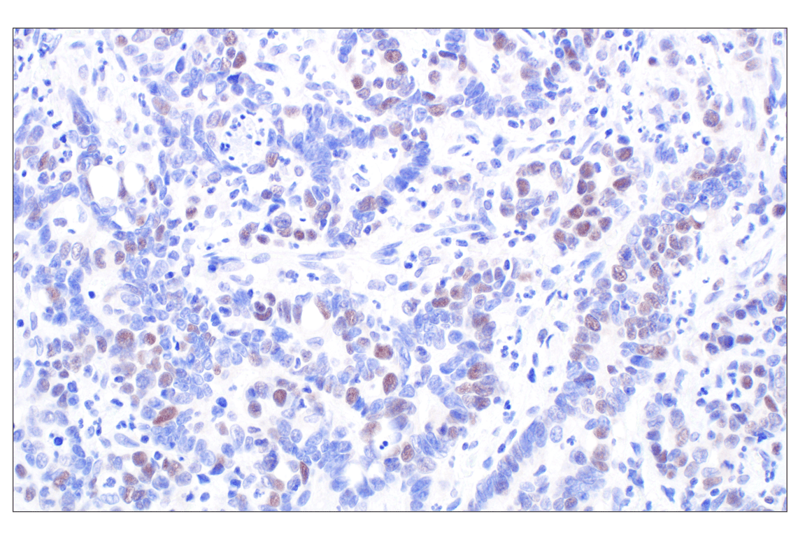 Immunohistochemistry Image 4: MASTL (F7I2C) Rabbit mAb