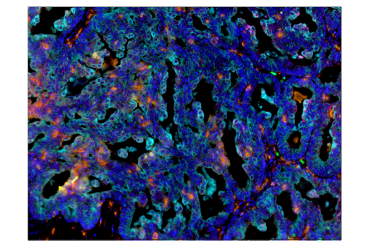 Immunohistochemistry Image 6: CD68 (D4B9C) XP<sup>®</sup> Rabbit mAb (BSA and Azide Free)
