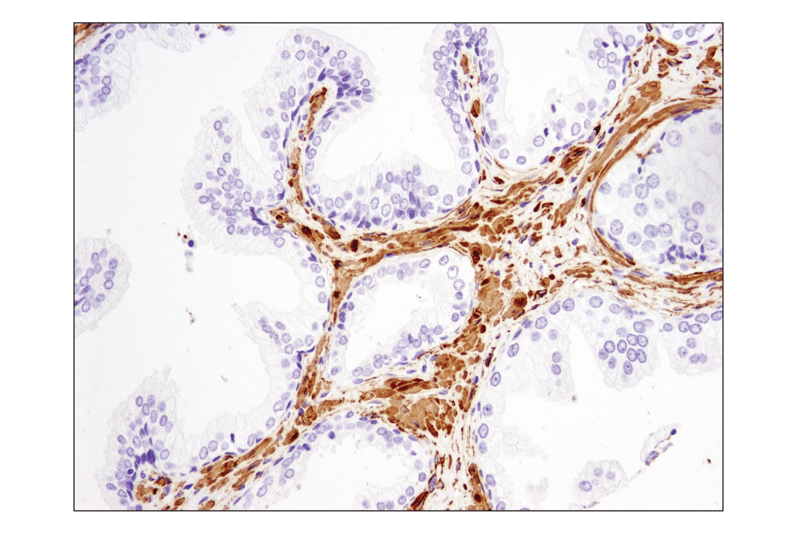 Immunohistochemistry Image 5: α-Smooth Muscle Actin (D4K9N) XP<sup>®</sup> Rabbit mAb (BSA and Azide Free)