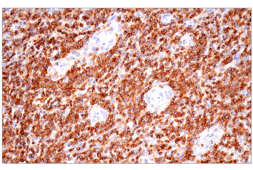 Immunohistochemistry Image 9: SLAMF6/CD352 (E3H1E) XP<sup>®</sup> Rabbit mAb (BSA and Azide Free)