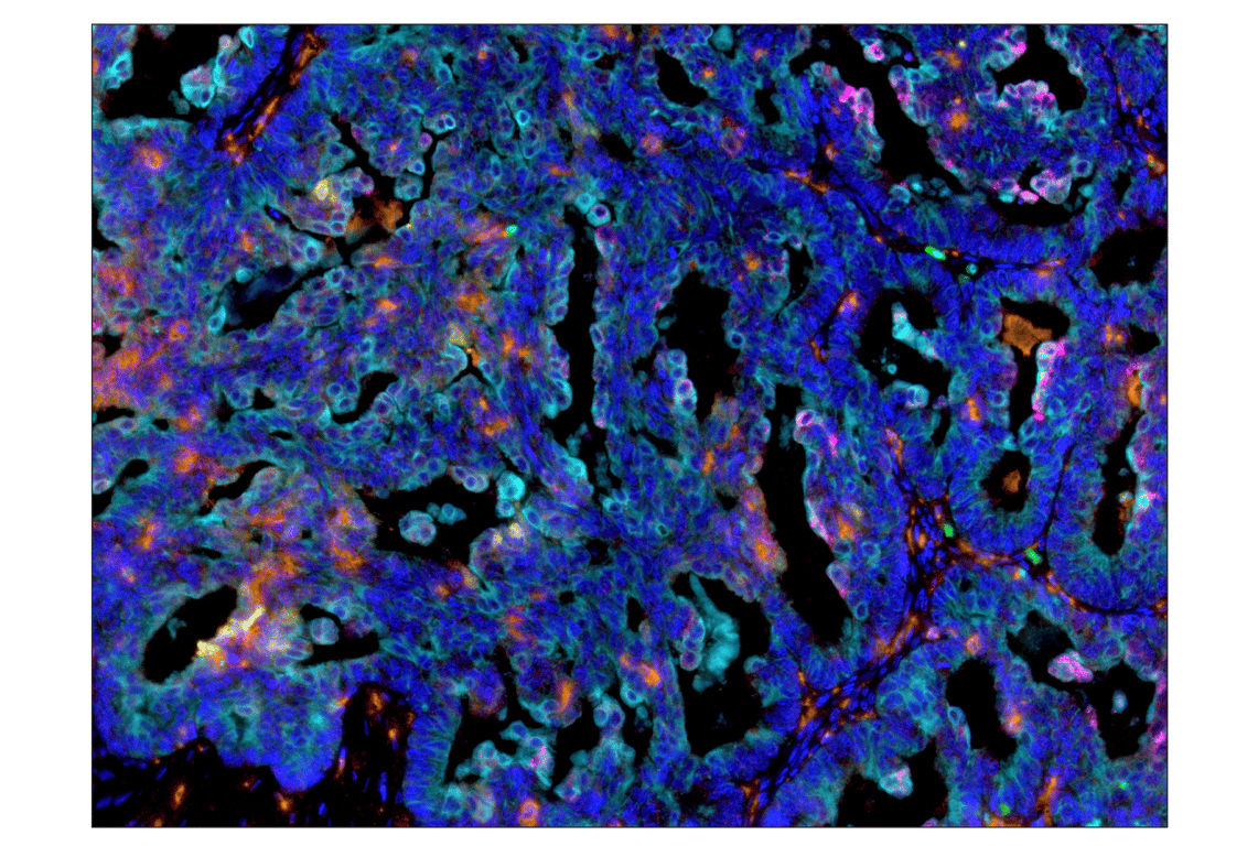 Immunohistochemistry Image 5: PD-L1 (E1L3N<sup>®</sup>) XP<sup>®</sup> Rabbit mAb (BSA and Azide Free)