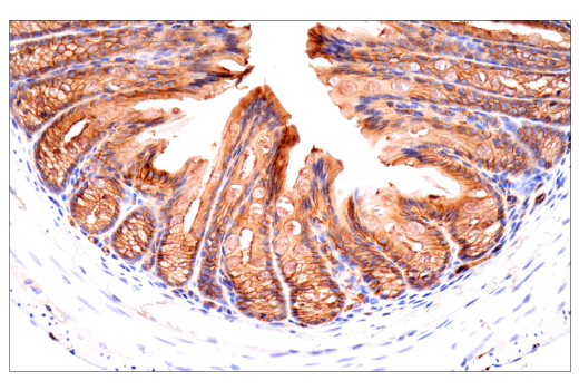 Immunohistochemistry Image 13: CD38 (E9F5A) XP<sup>®</sup> Rabbit mAb