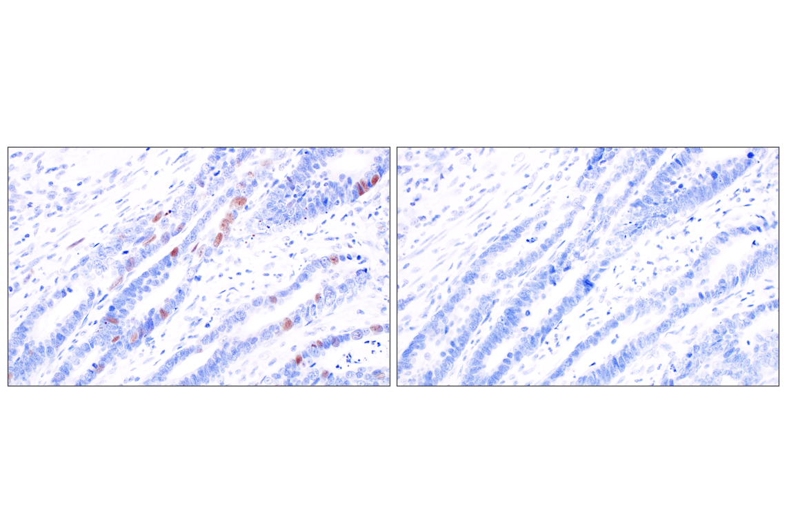 undefined Image 21: Non-Homologous End Joining (NHEJ) DNA Repair Antibody Sampler Kit