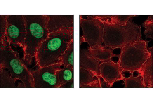 Immunofluorescence Image 1: Phospho-SirT1 (Ser47) Antibody