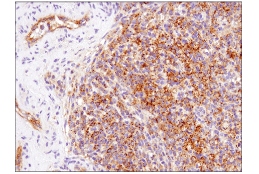 undefined Image 38: Host Cell Viral Restriction Factor Antibody Sampler Kit