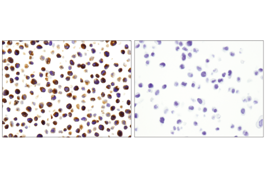 Immunohistochemistry Image 3: Myeloperoxidase (E1E7I) XP<sup>®</sup> Rabbit mAb (BSA and Azide Free)