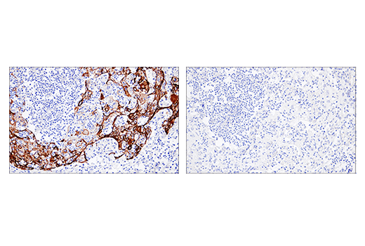 Immunohistochemistry Image 4: Keratin 5 (E2T4B) XP<sup>®</sup> Rabbit mAb