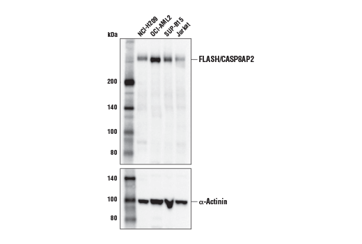 Western Blotting Image 2: FLASH/CASP8AP2 (D3T8Q) Rabbit mAb