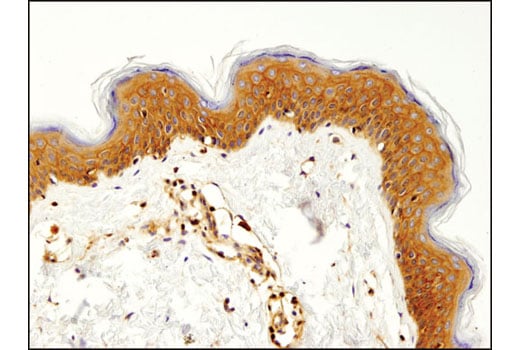 undefined Image 22: MHC Class I Antigen Processing and Presentation Antibody Sampler Kit