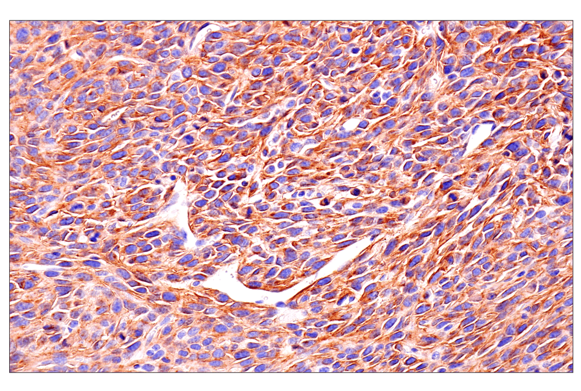 Immunohistochemistry Image 3: Axl (E3Z2H) Rabbit mAb