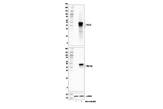 Western Blotting Image 2: HLA-G (E8N9C) XP<sup>®</sup> Rabbit mAb