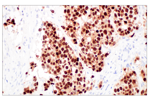 Immunohistochemistry Image 2: POU2F3 (E5N2D) XP<sup>®</sup> Rabbit mAb