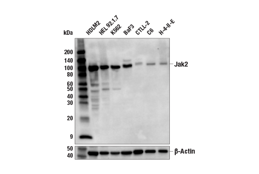 Western Blotting Image 3: Jak2 (D2E12) XP<sup>®</sup> Rabbit mAb (Biotinylated)