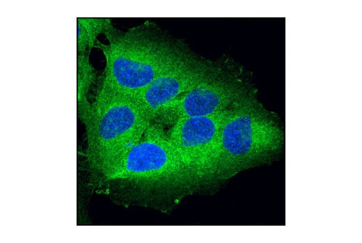 undefined Image 14: Apoptosis/Necroptosis Antibody Sampler Kit