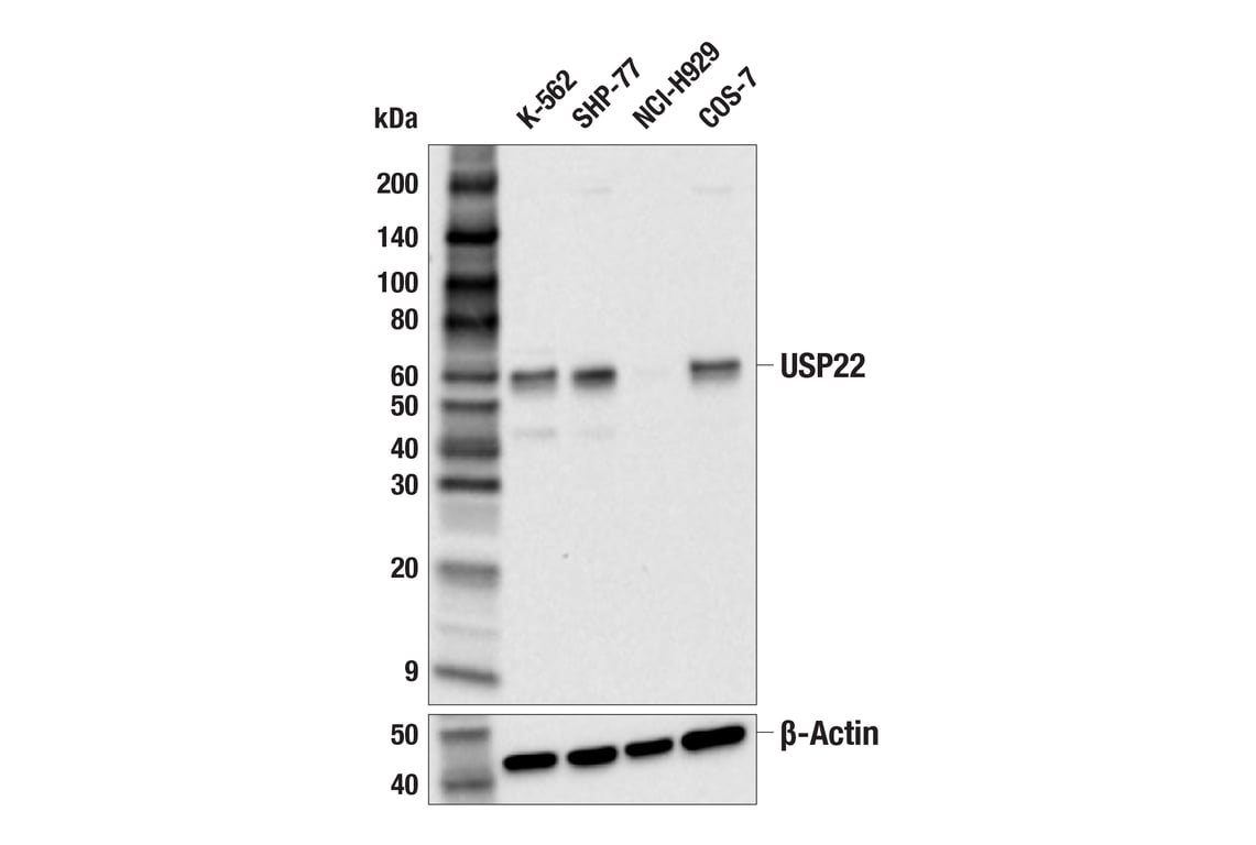 Western Blotting Image 1: USP22 (F4M4V) Rabbit mAb