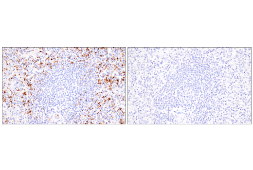 Immunohistochemistry Image 8: CD62P/P-Selectin (E8Q1W) XP<sup>®</sup> Rabbit mAb (BSA and Azide Free)