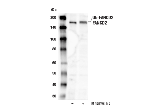 undefined Image 10: Fanconi Anemia Antibody Sampler Kit