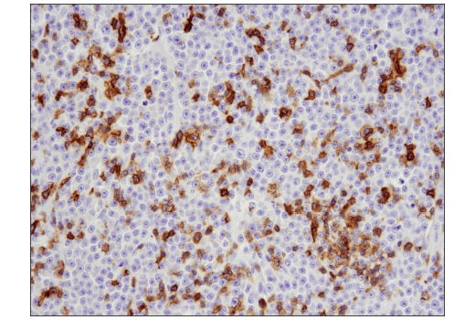 Immunohistochemistry Image 1: CD5 (E8X3S) XP<sup>®</sup> Rabbit mAb (BSA and Azide Free)