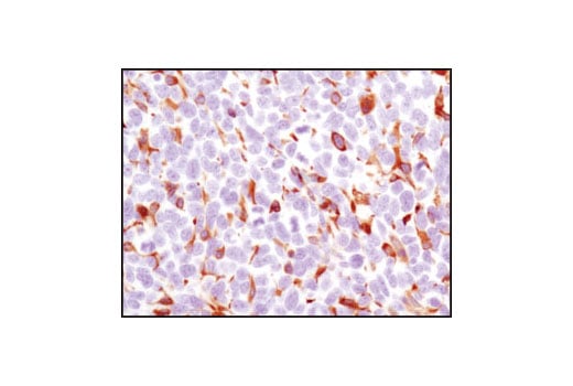 undefined Image 27: Microglia Cross Module Antibody Sampler Kit