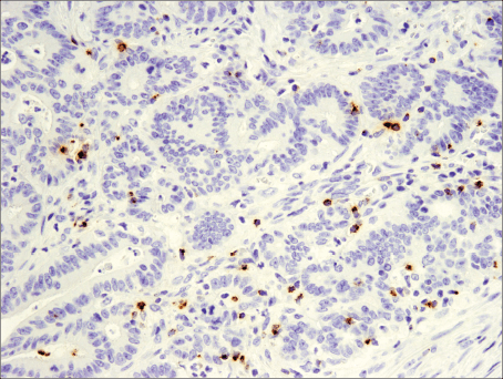 使用 CD19 (Intracellular Domain) (D4V4B) XP<sup>®</sup> Rabbit mAb 对石蜡包埋的人扁桃体细胞进行免疫组织化学分析。