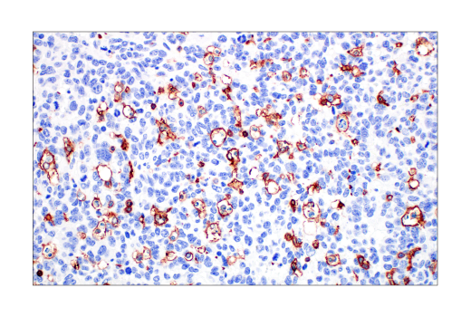 Immunohistochemistry Image 3: Integrin β2 (E9O7W) Rabbit mAb (BSA and Azide Free)