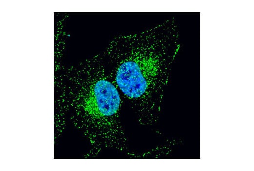 Immunofluorescence Image 1: APPL1 (D83H4) XP<sup>®</sup> Rabbit mAb