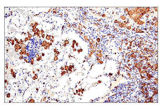 Immunohistochemistry Image 1: Iba1/AIF-1 (E4O4W) XP<sup>®</sup> Rabbit mAb (BSA and Azide Free)