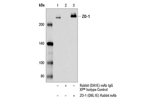 undefined Image 11: Epithelial-Mesenchymal Transition (EMT) IF Antibody Sampler Kit