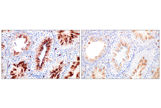 Immunohistochemistry Image 7: CD206/MRC1 (E6T5J) XP<sup>®</sup> Rabbit mAb (BSA and Azide Free)