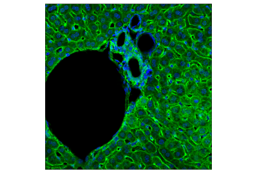 undefined Image 33: PICALM Signaling Antibody Sampler Kit