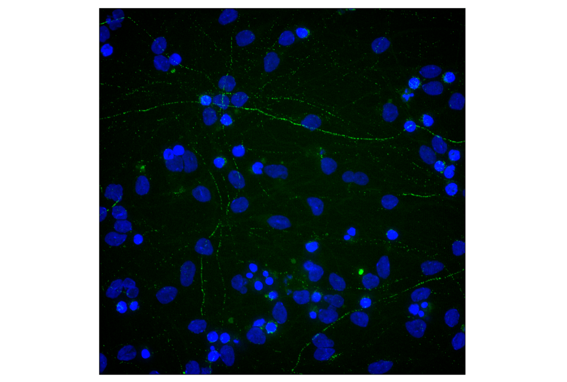Immunofluorescence Image 2: Neurofilament-H (E7Z7G) Rabbit mAb