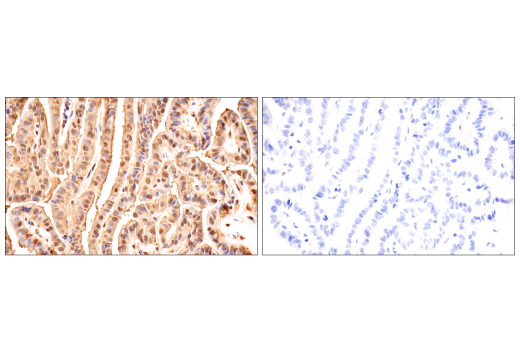 Immunohistochemistry Image 15: Ubiquitin (E6K4Y) XP<sup>®</sup> Rabbit mAb (BSA and Azide Free)