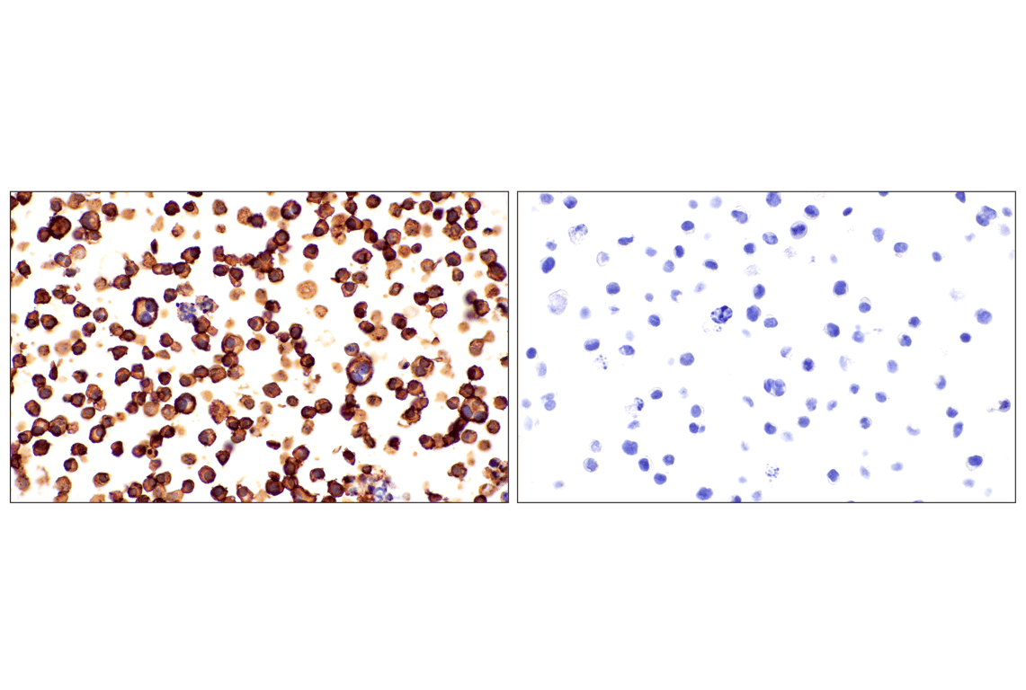 Immunohistochemistry Image 18: Syndecan 1 (E7F7T) Rabbit mAb