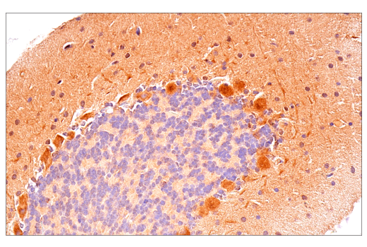 Immunohistochemistry Image 11: p70 S6 Kinase (E8K6T) XP<sup>®</sup> Rabbit mAb